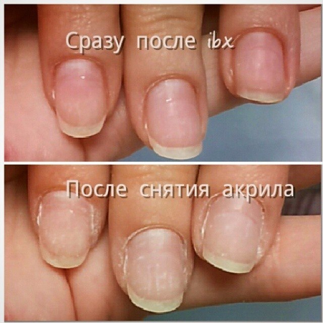 Пропил на ногтях после аппаратного маникюра фото