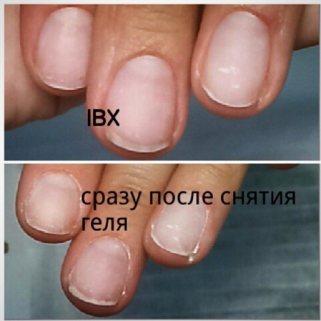 Фото ibx до и после